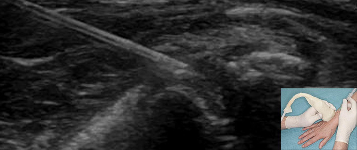 https://www.drakonaki.gr/files/files/slider-inner/egxiseis-se-arthroseis.jpg